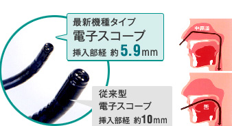 最新機種タイプ電子スコープ 挿入部経 約5.9mm 従来型電子スコープ 挿入部経 約10mm